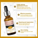 Acne Scar Removal Rejuvenation Serum | Scar, C section & Stretch Mark Removal Oil for women