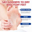 Aichun beauty moisturizing foot cream, dead skin care cream, foot removal cream for cracked heels 20g AC2042